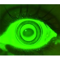 AnterVue Eye Imaging Camera