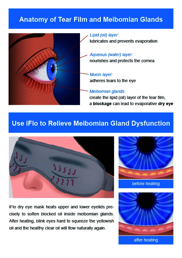 iFlo-USB Heating Eye Mask