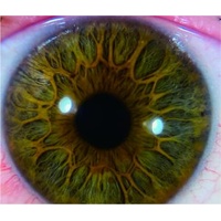 AnterVue Eye Imaging Camera