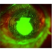 AnterVue Eye Imaging Camera