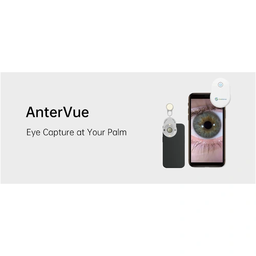 AnterVue Eye Imaging Camera