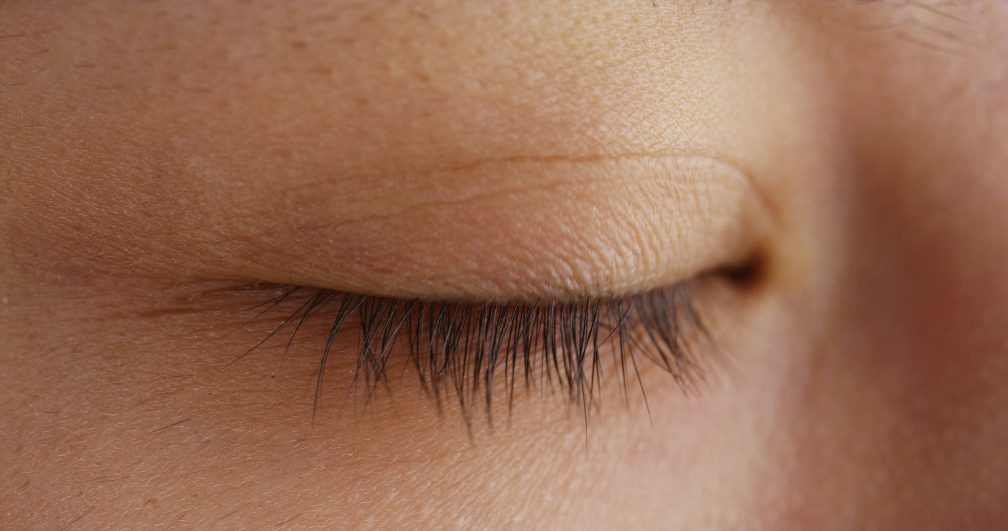 Eyelid Hygiene 
